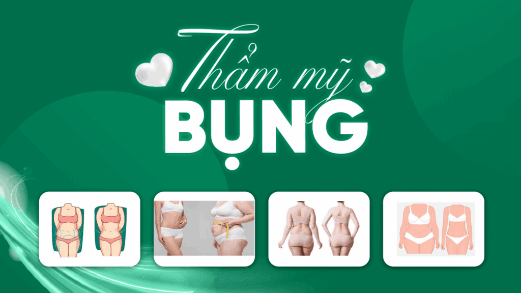 Thẩm mỹ bụng (vòng 2)