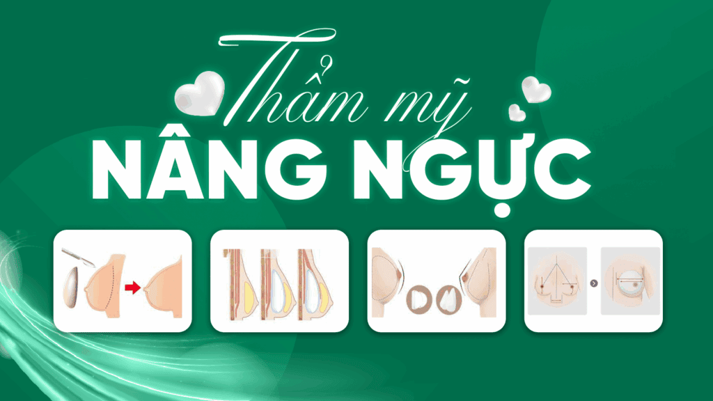 nâng ngực thẩm mỹ