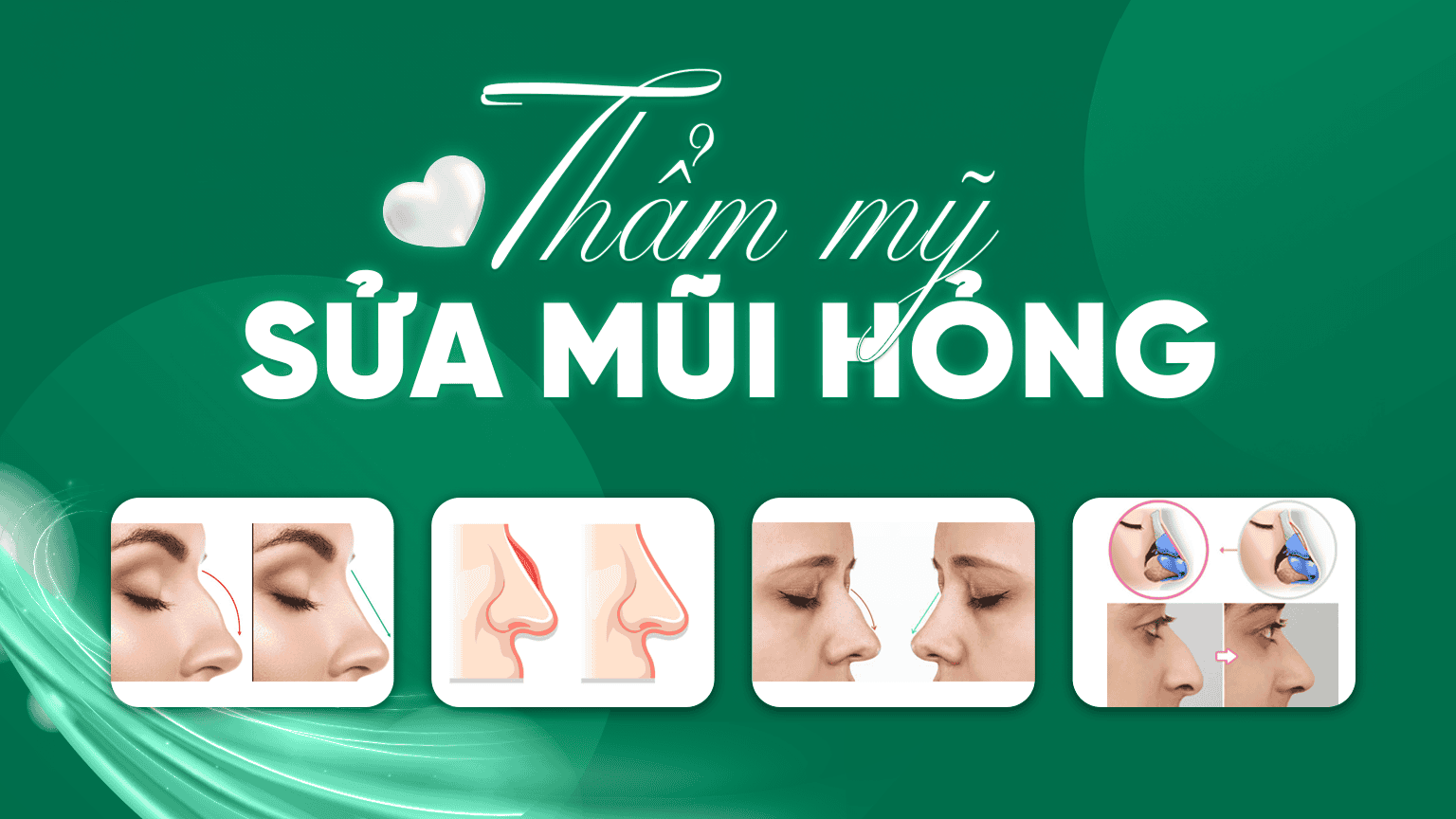 sua mui hong