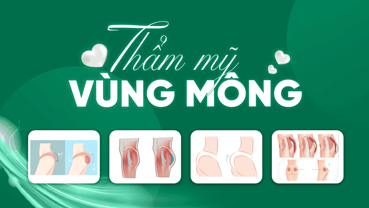 thẩm mỹ vùng mông